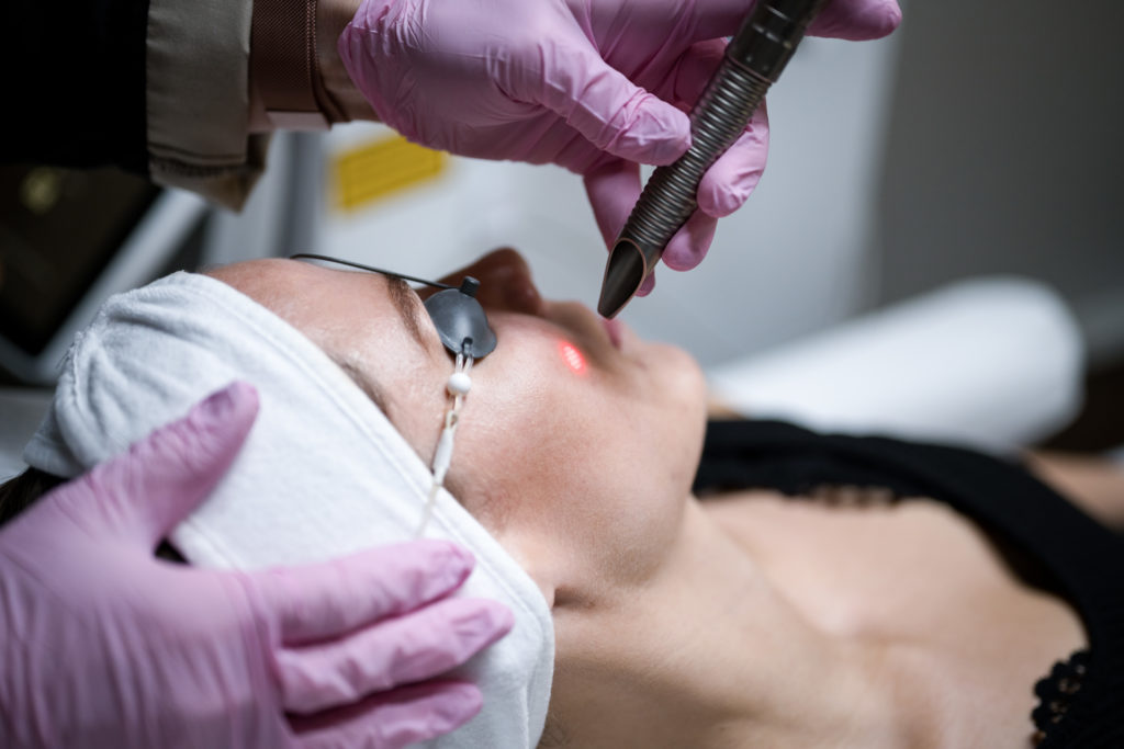 Fotona 4D. Laserbehandling med Fotona Dynamisför skin tightening