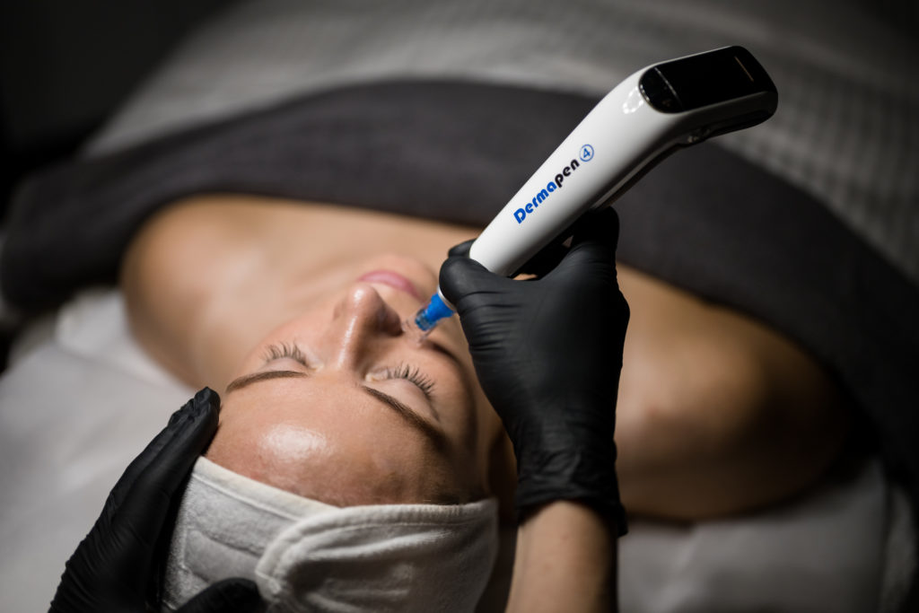 Microneedling med Dermapen