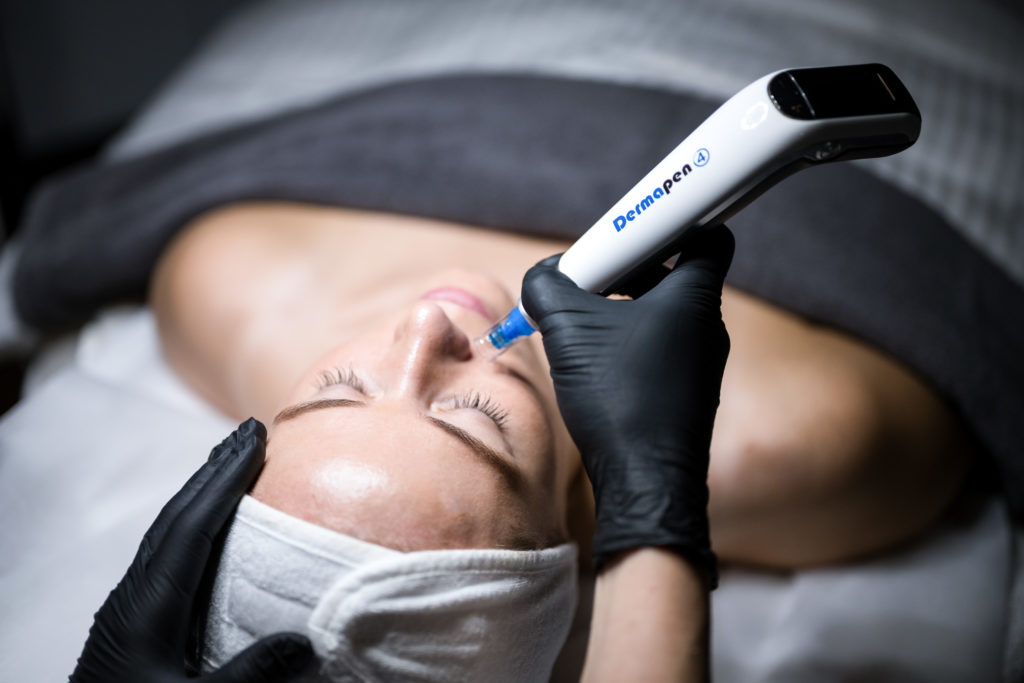 Ansiktsbehandling med microneedling